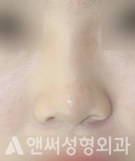 Answer Plastic Surgery case 282: Before