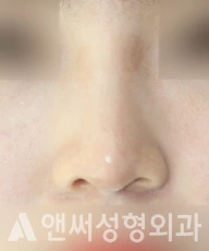 Answer Plastic Surgery case 282: After