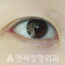 Answer Plastic Surgery case 281: After