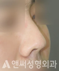 Answer Plastic Surgery case 280: Before