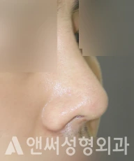 Answer Plastic Surgery case 280: After