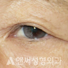 Answer Plastic Surgery case 279: Before