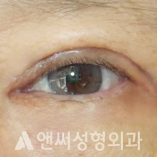 Answer Plastic Surgery case 279: After