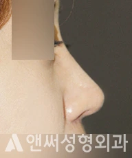 Answer Plastic Surgery case 278: After