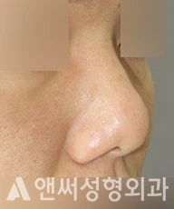 Answer Plastic Surgery case 277: Before