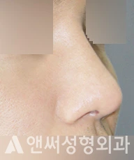 Answer Plastic Surgery case 277: After