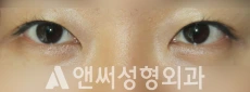 Answer Plastic Surgery case 276: Before