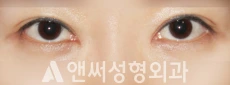 Answer Plastic Surgery case 276: After