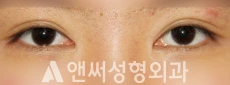 Answer Plastic Surgery case 275: Before