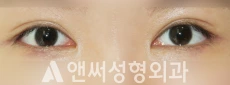 Answer Plastic Surgery case 275: After