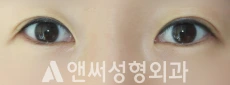 Answer Plastic Surgery case 274: Before