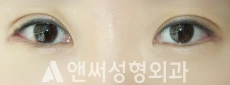 Answer Plastic Surgery case 274: After