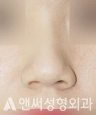 Answer Plastic Surgery case 273: Before
