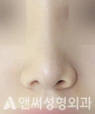 Answer Plastic Surgery case 273: After