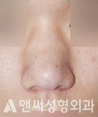 Answer Plastic Surgery case 272: Before
