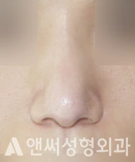 Answer Plastic Surgery case 272: After