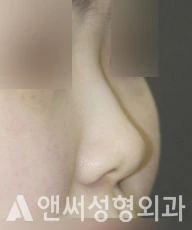 Answer Plastic Surgery case 271: Before