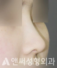 Answer Plastic Surgery case 271: After