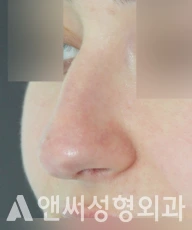 Answer Plastic Surgery case 270: Before