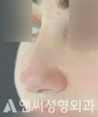 Answer Plastic Surgery case 270: After