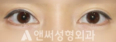 Answer Plastic Surgery case 269: Before