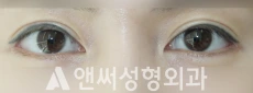 Answer Plastic Surgery case 269: After