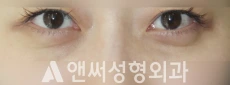 Answer Plastic Surgery case 268: Before