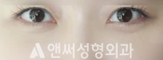 Answer Plastic Surgery case 268: After