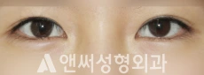 Answer Plastic Surgery case 267: Before