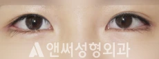 Answer Plastic Surgery case 267: After