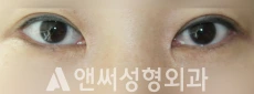Answer Plastic Surgery case 266: Before