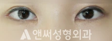 Answer Plastic Surgery case 266: After
