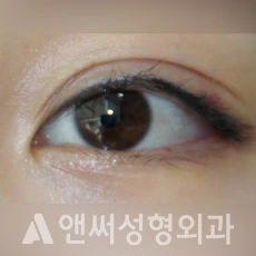 Answer Plastic Surgery case 265: After