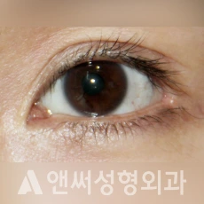 Answer Plastic Surgery case 264: Before