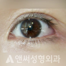 Answer Plastic Surgery case 264: After