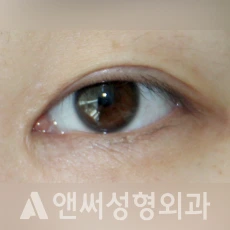 Answer Plastic Surgery case 263: Before