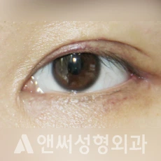 Answer Plastic Surgery case 263: After