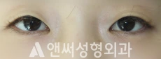 Answer Plastic Surgery case 262: Before