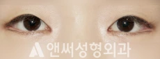 Answer Plastic Surgery case 262: After