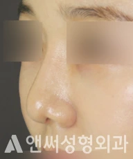 Answer Plastic Surgery case 261: Before