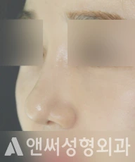 Answer Plastic Surgery case 261: After