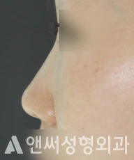Answer Plastic Surgery case 260: Before