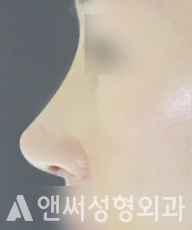 Answer Plastic Surgery case 260: After