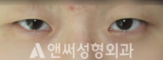 Answer Plastic Surgery case 259: Before
