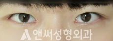 Answer Plastic Surgery case 259: After