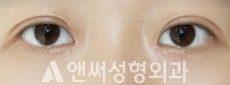 Answer Plastic Surgery case 258: After