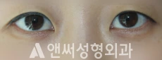 Answer Plastic Surgery case 257: Before