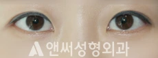 Answer Plastic Surgery case 257: After