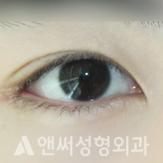 Answer Plastic Surgery case 256: After
