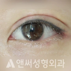 Answer Plastic Surgery case 255: After